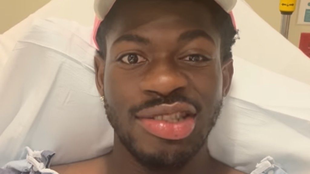 Lil Nas X Suffers From Partial Face Paralysis